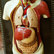 Morbus Crohn und Colitis ulcerosa 