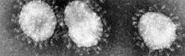 Das Coronavirus wurde für extrem viele Menschen ganz überraschend ein sehr ernstes Thema