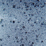 Die Gefahr von Mikroplastik